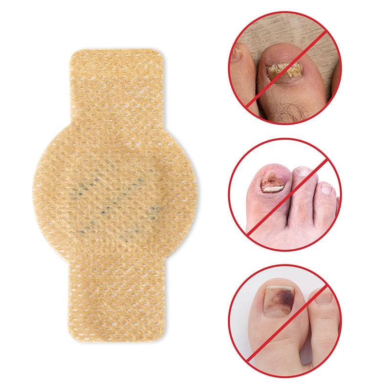 FungalPatch - Antibakteriel Svampepatch Og Neglepleje Pakk
